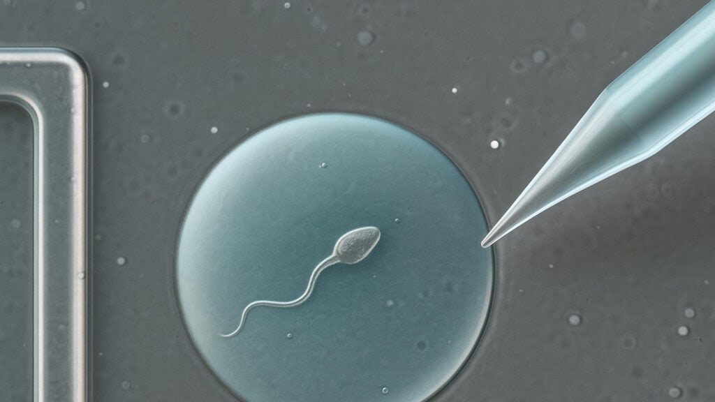 STAR Sperm Tracking and Recovery AI fertility technology at Columbia University